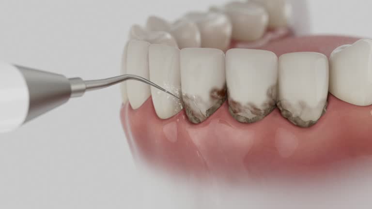 Trusted Tooth Extraction service in Muscatine, IA - Dentist Open Now